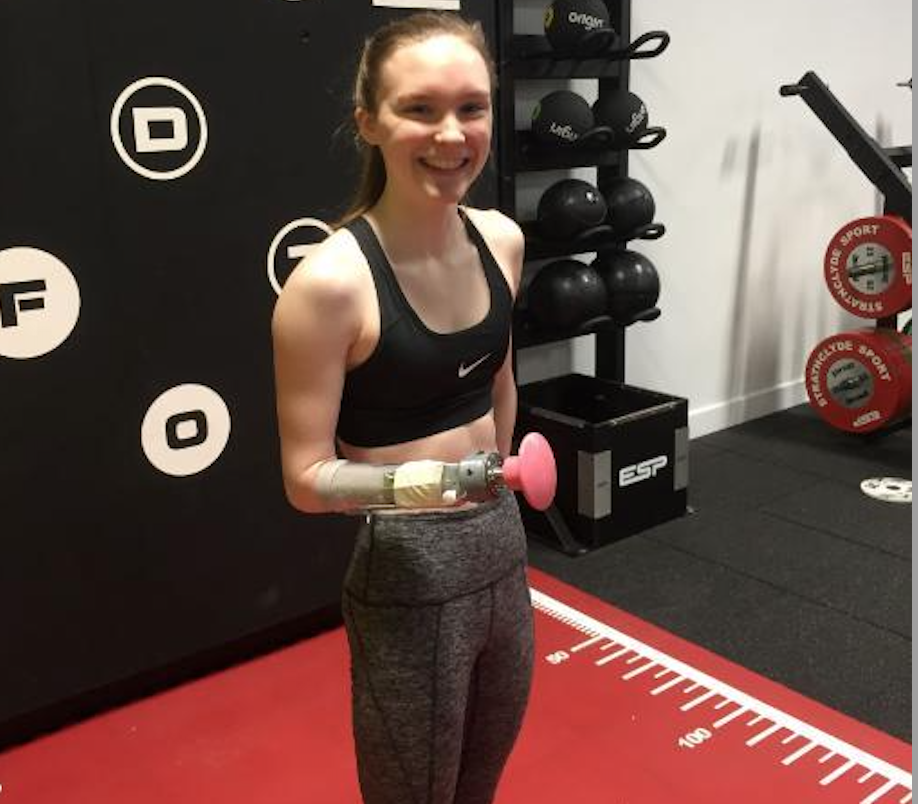 Paralympian Receives Adaptable Prosthetic Arm